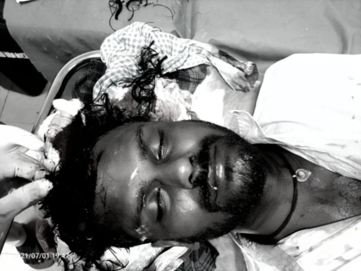 வெடி விபத்தில் காயம்பட்டவர்கள்
