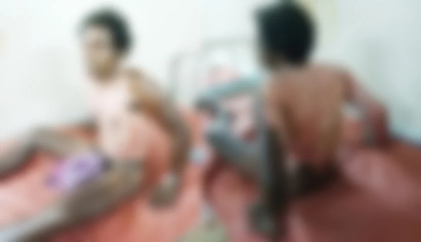 எரிந்த நிலையில் மருத்துவமனையில் அனுமதிக்கப்பட்ட நபர்