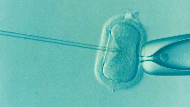 #IVF