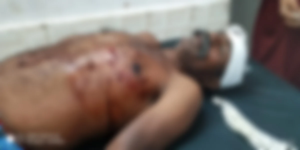 சிறுத்தையால் தாக்கப்பட்ட விவசாயி