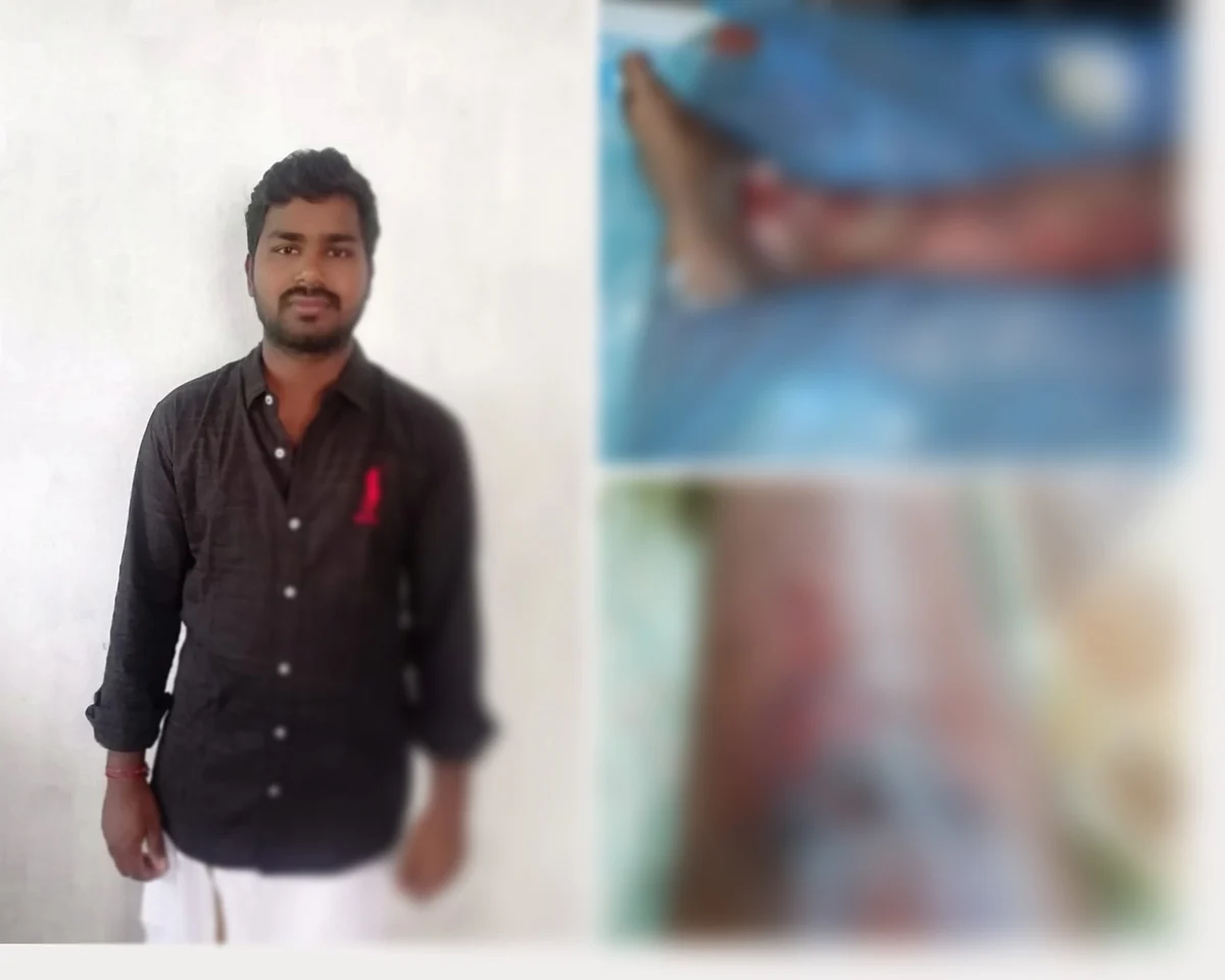 விஜயகுமார் - கால் செப்டிக் ஆன நிலையில்...