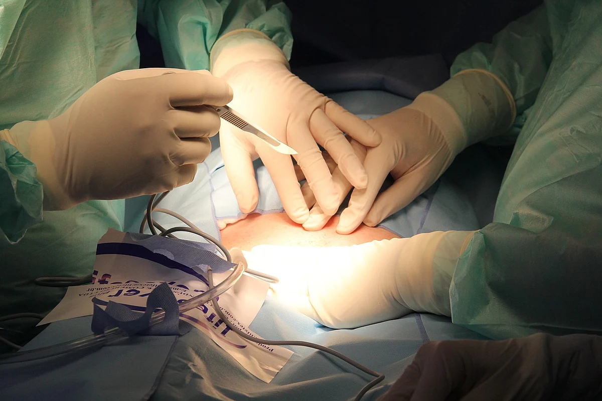 Surgery (Representational Image)