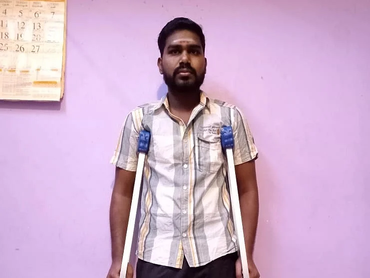 `காலை மட்டுமல்ல, வாழ்க்கையையும் பறிச்சிடுச்சு கறுப்புப் பூஞ்சை!' - கண்ணீரில் விழுப்புரம் இளைஞர்