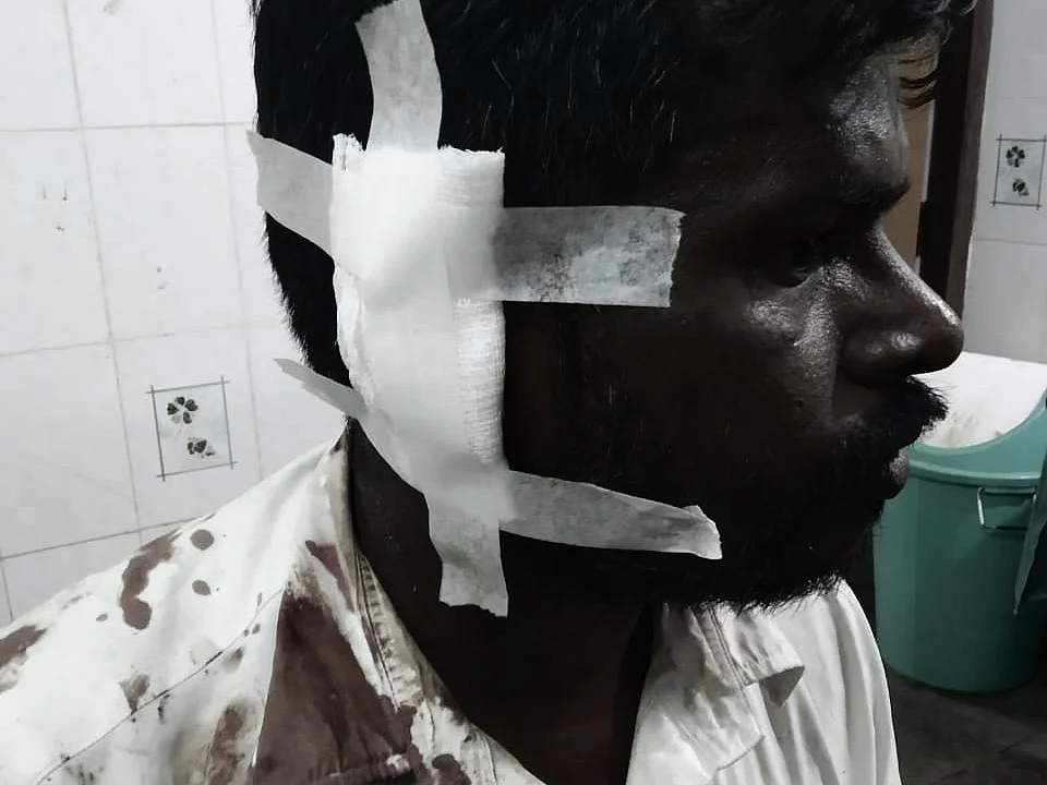 `ஏன் ஆட்டோவுக்கு ஓட்டுப் போடலை..?!’ -தந்தையைத் தாக்க முயன்றவரின் காதைக் கடித்துத் துண்டாக்கிய மகன்