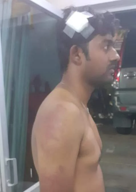 தாக்கப்பட்ட பயிற்சி மருத்துவர் முருகப்பெருமாள்