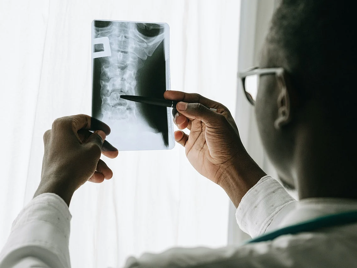 World Radiology Day: `ஆசியாவின் முதல் X-ray கருவி நிறுவப்பட்டது சென்னையில்தான்!' - சுவாரஸ்ய வரலாறு