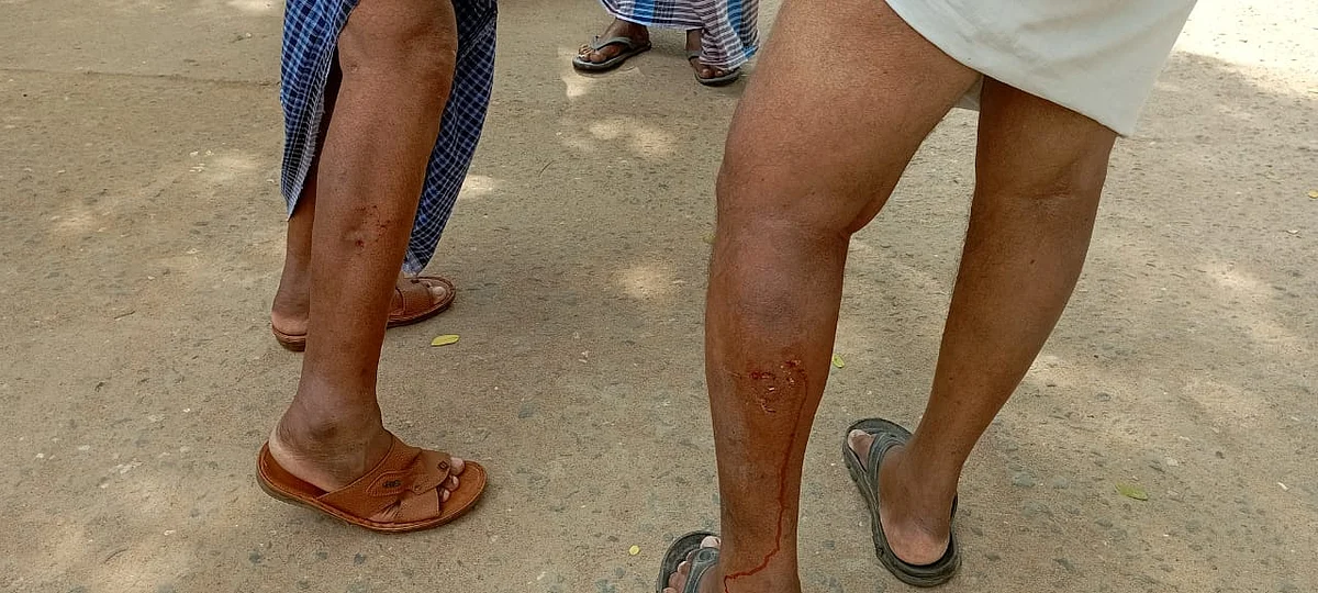 நாய் கடித்ததில் பாதிக்கப்பட்டவர்கள்