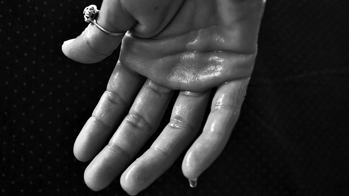 Sweat Hands (Representational Image)