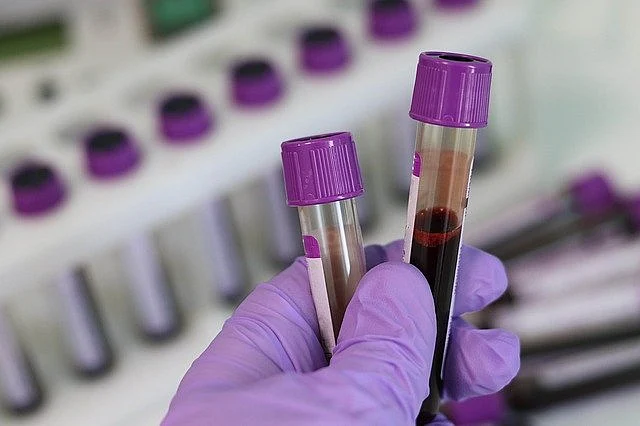கொரோனா வைரஸ் உடலில் 90 நாட்கள் இருக்குமா!? - விளக்கம்! 4 laboratory 3827736 640 Tamil News Spot
