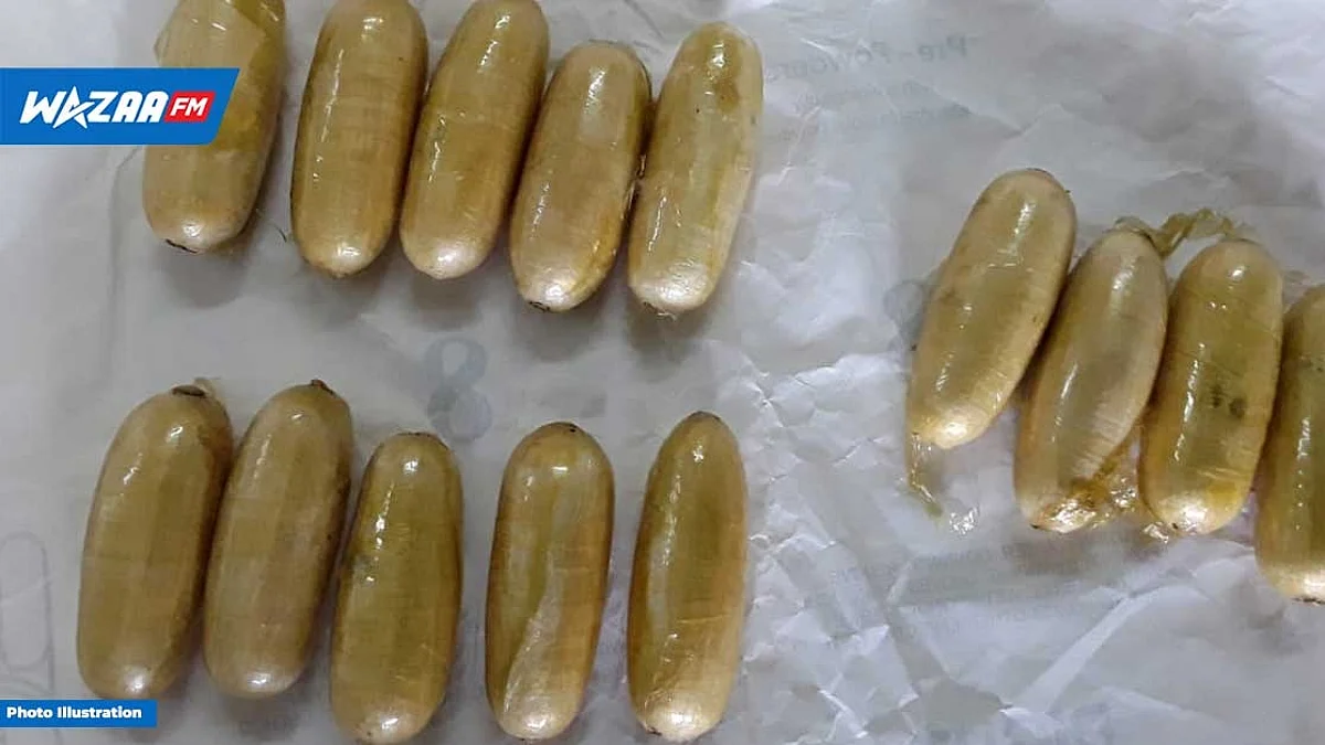 L’aéroport de Plaisance : 119 boulettes de drogue détectées grâce au scanner corporel