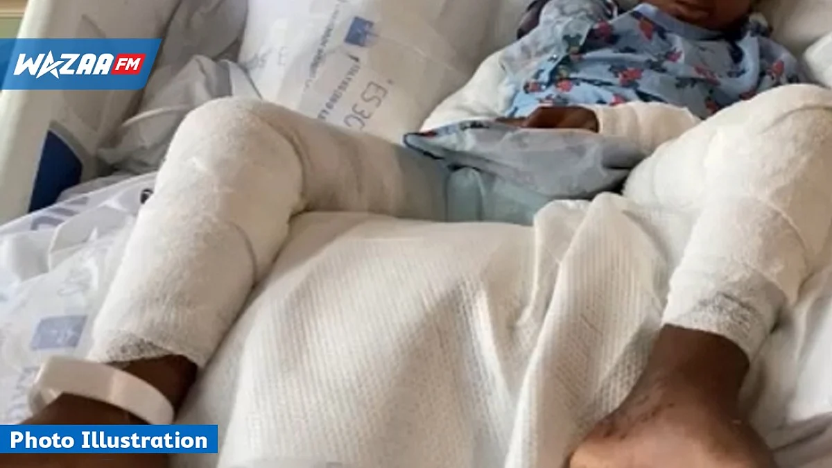 Un écolier de 7 ans tombe sur de la braise après une chute de vélo
