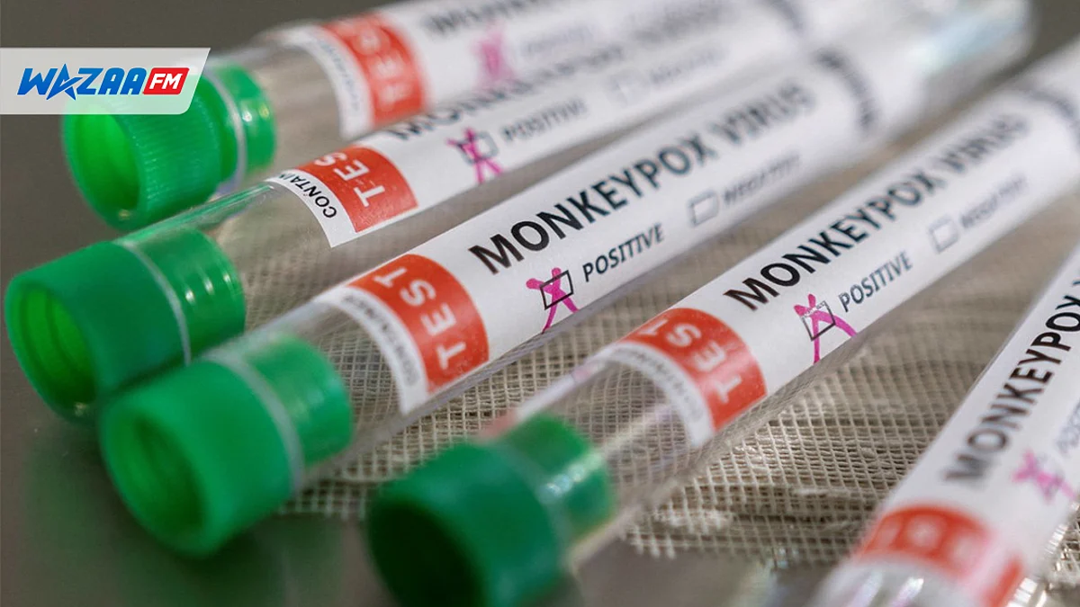 Variole du singe : les unités de santé demeurent mobilisées