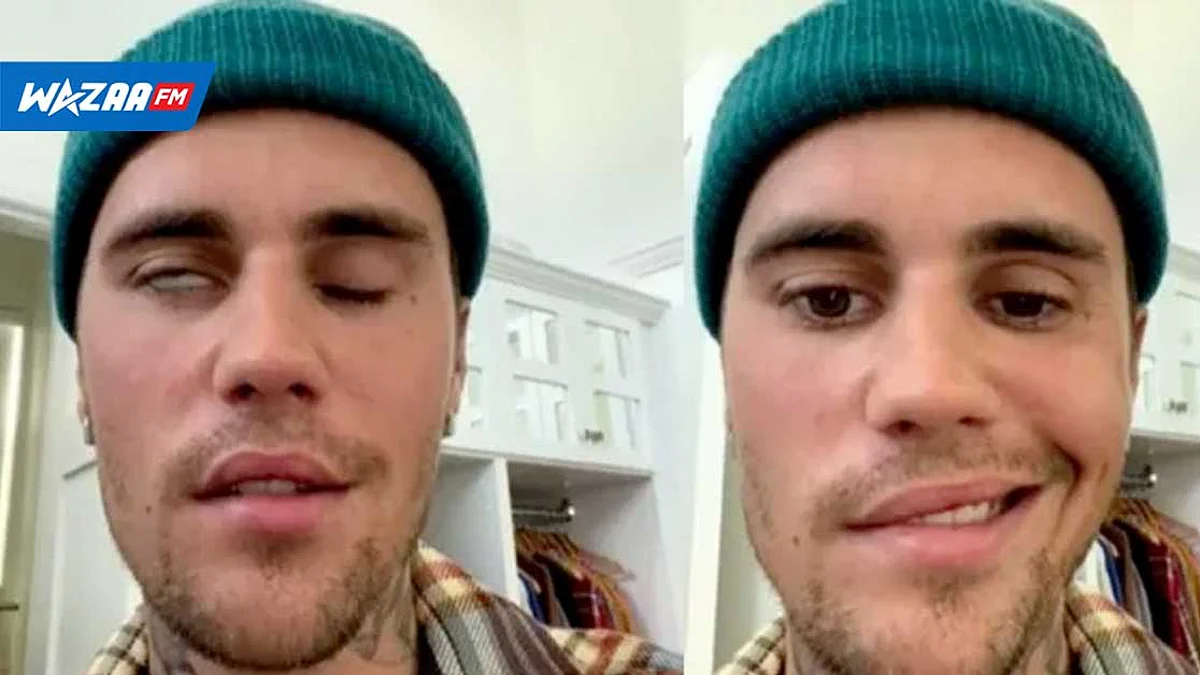 Justin Bieber est affecté par le syndrome de Ramsay Hunt - "Je fais confiance à Dieu et tout arrive pour une raison