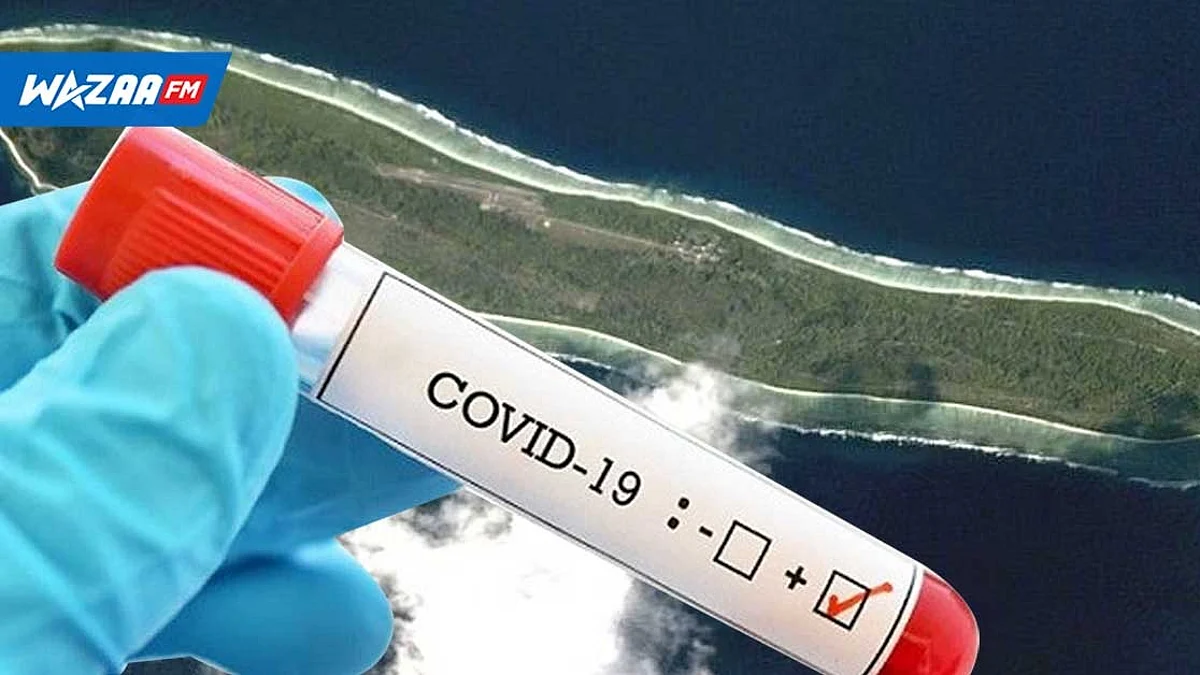 COVID-19 : 93 cas positifs, selon les derniers chiffres