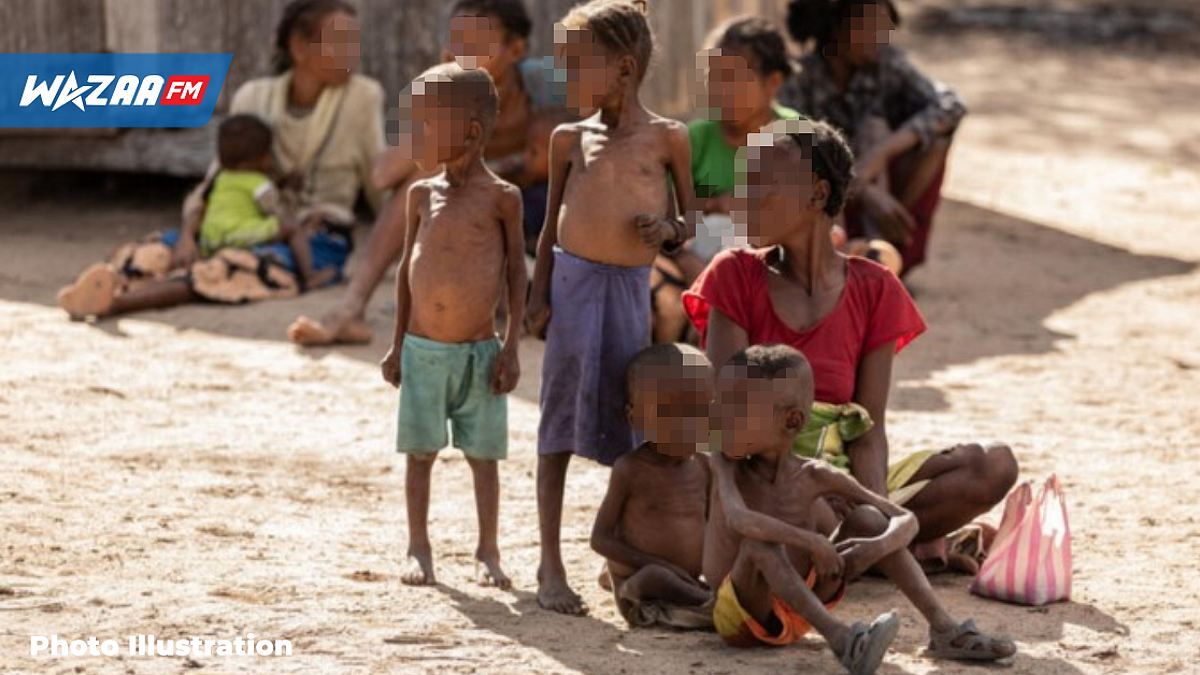 Afrique : des millions d'enfants souffrent de malnutrition