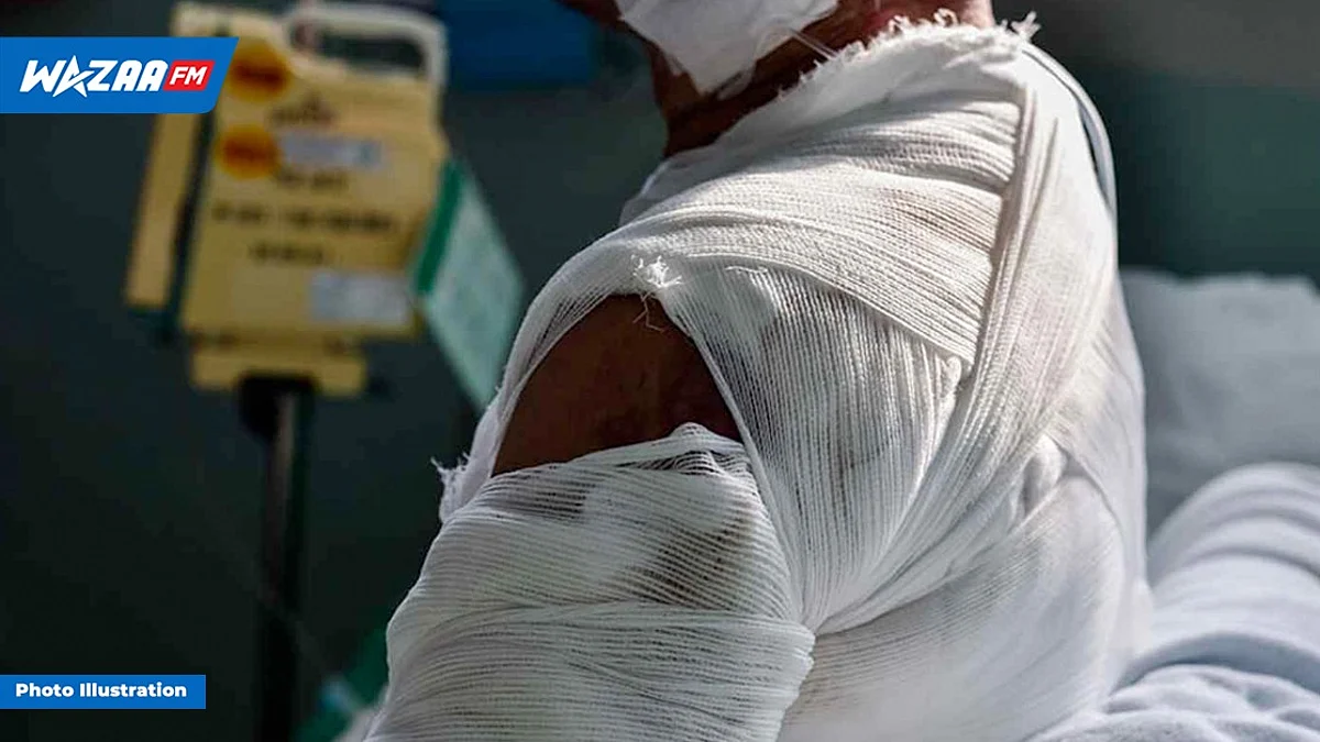 Phoenix : explosion d’une machine à souder, un Bangladais dans un état préoccupant