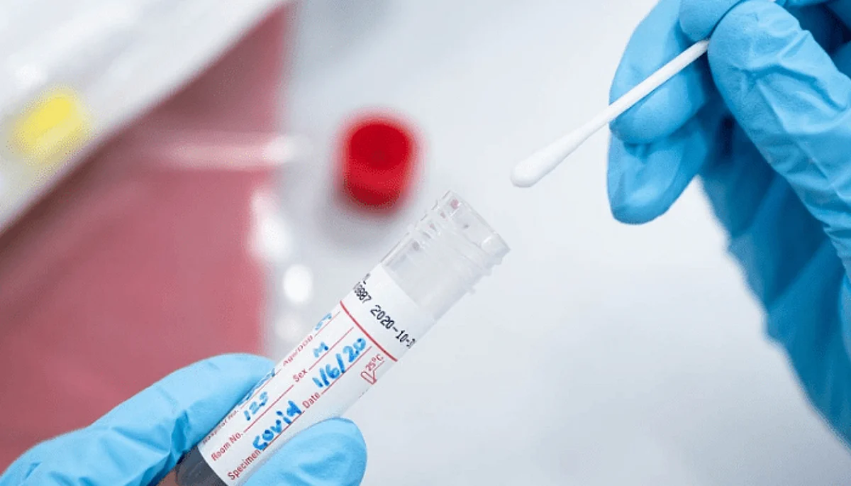 Nigeria records no COVID-19 death in seven days – NCDC