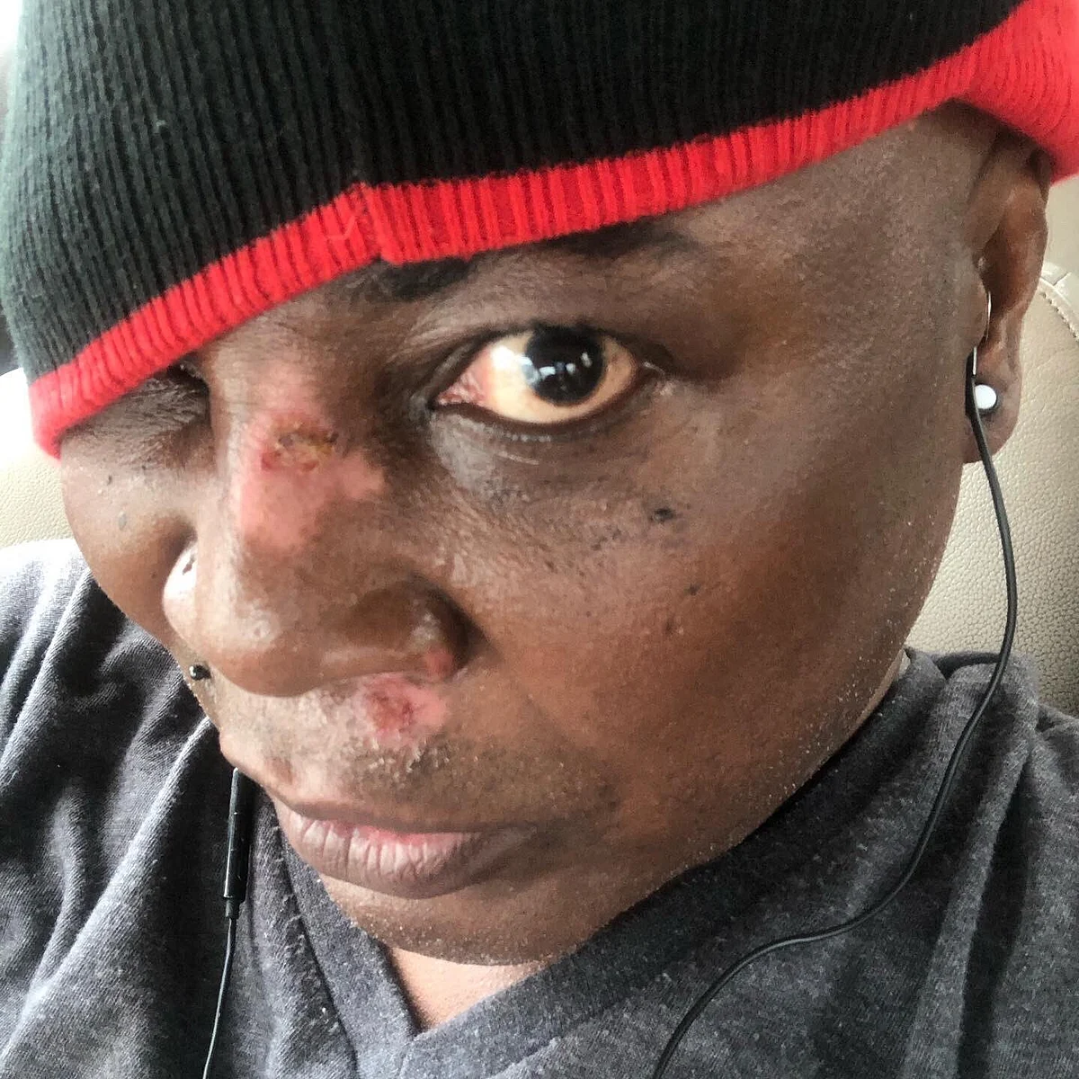 PHOTOS: Charly Boy sustains injuries in scooter accident