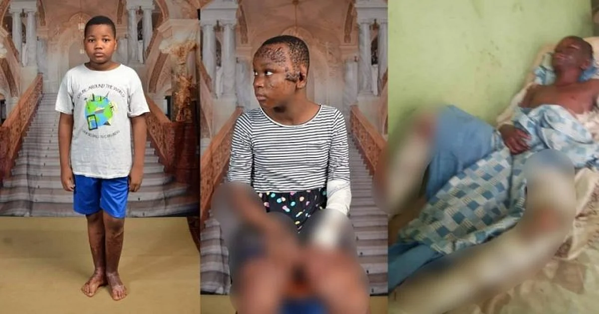 How my children graciously survived Ebonyi fire explosion - Man recounts