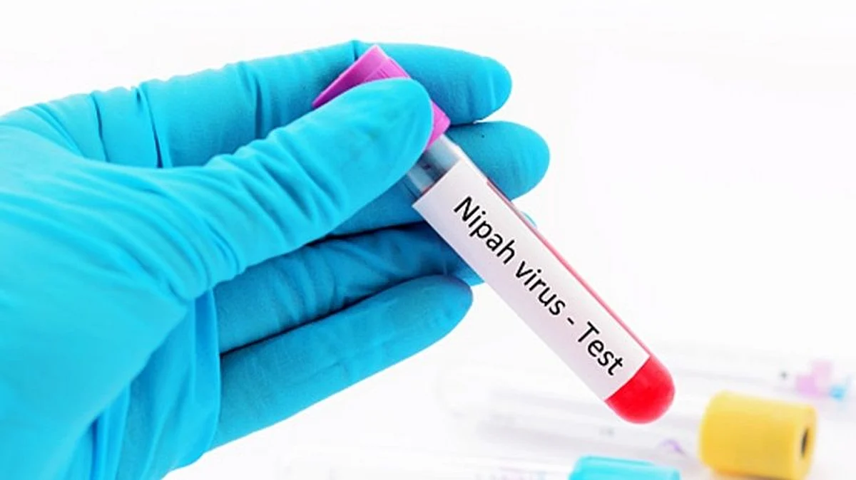 निपाह वायरस से 12 साल के बच्चे की मौत, केरल पहुंची केंद्रीय टीम