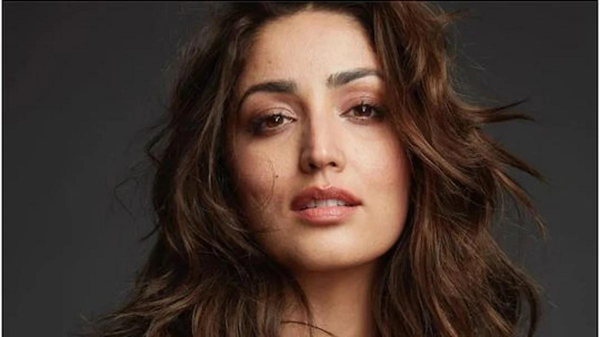 'Keratosis Pilaris' बीमारी से पीड़ित हैं Yami Gautam, एक्ट्रेस ने बताया- इसे स्वीकार करने में लग गए सालों