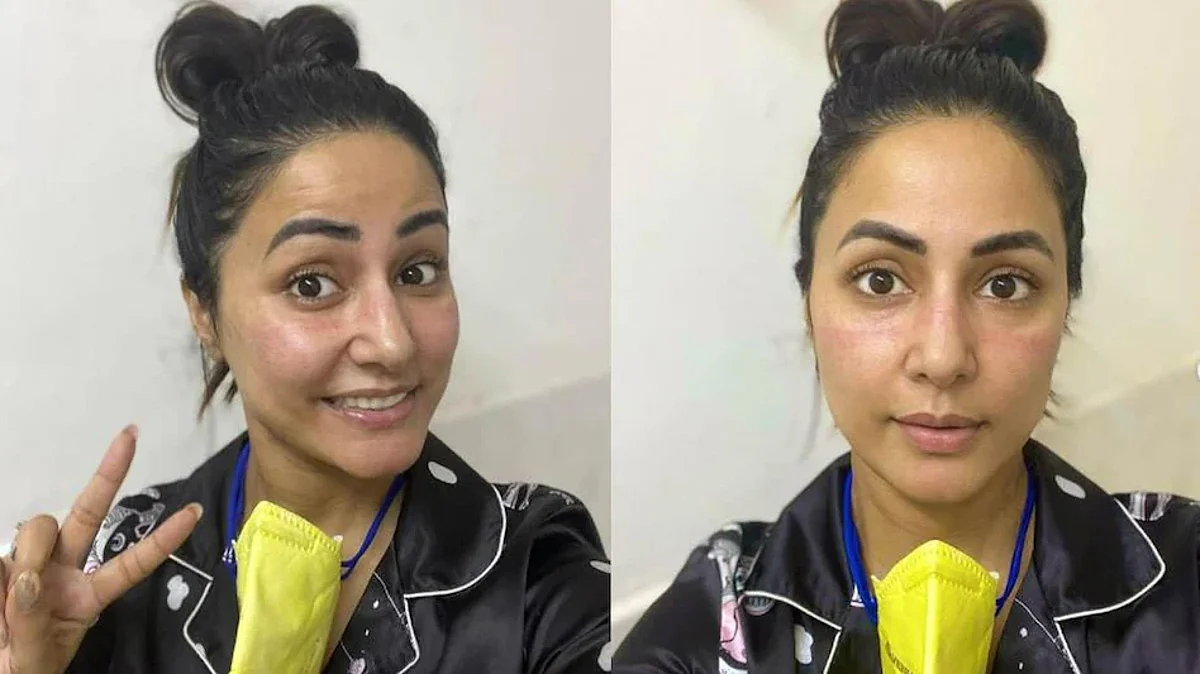 Hina Khan की पूरी फैमिली को हुआ कोरोना, लगातार मास्क पहनने से एक्ट्रेस का बिगड़ा चेहरा, सेल्फी शेयर कर बयां किया दर्द