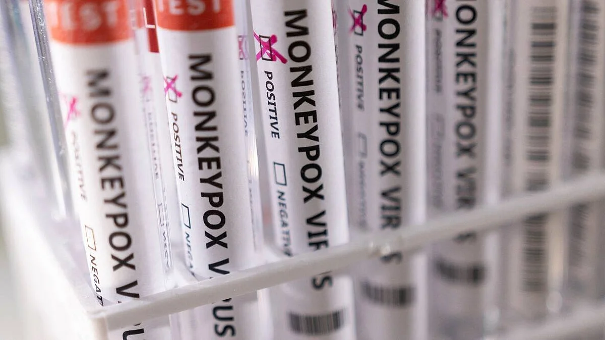 Monkeypox: केरल में विदेश से लौटे मंकीपॉक्स के एक संदिग्ध युवक की मौत, स्वास्थ्य विभाग ने दिए जांच के आदेश