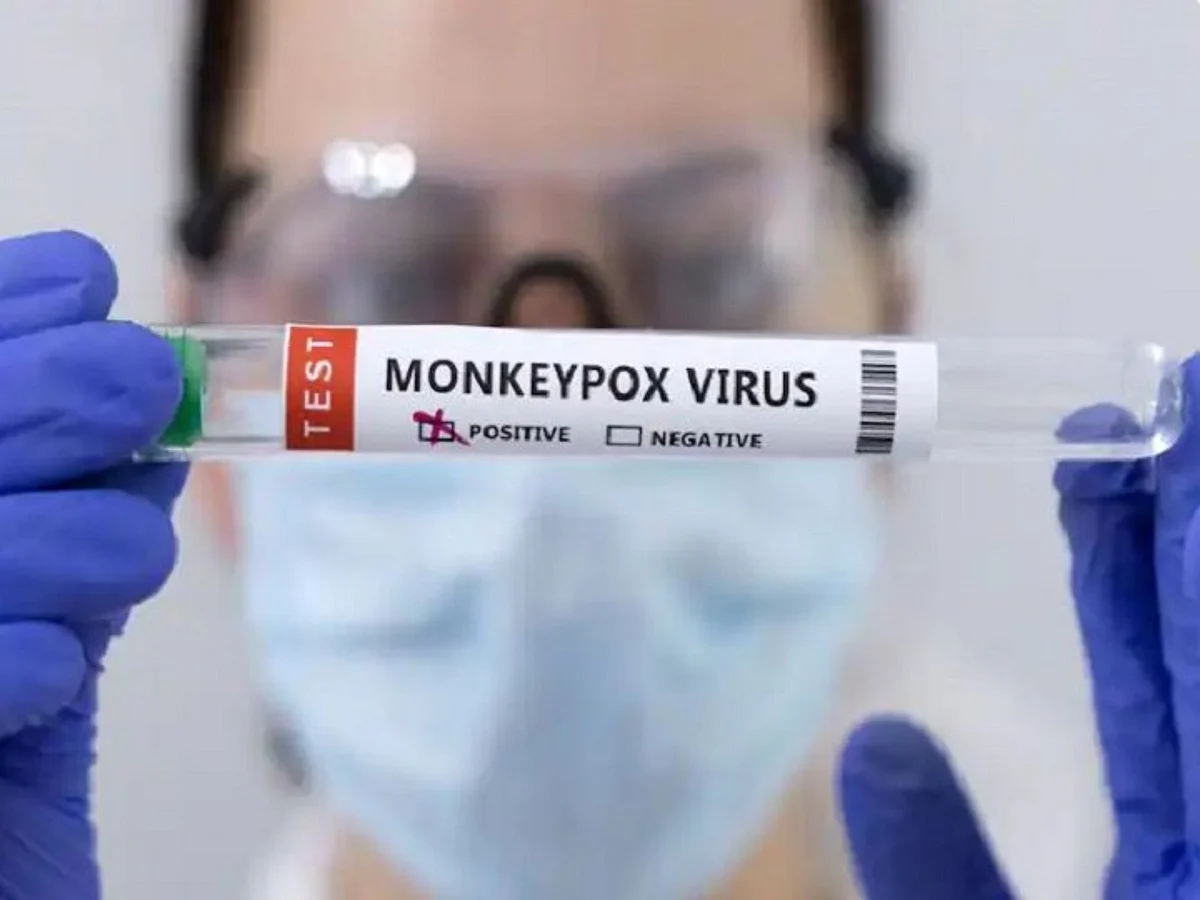 Monkeypox in Japan: जापान ने मंकीपॉक्स को रोकने के लिए चेचक के टीके के इस्तेमाल को मंजूरी दी